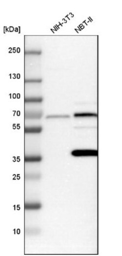 PICALM Antibody, Novus Biologicals 0.1mL; Unlabeled:Antibodies, Polyclonal